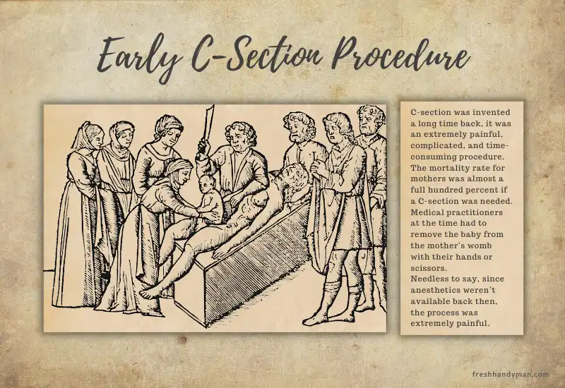 early-c-section-procedure